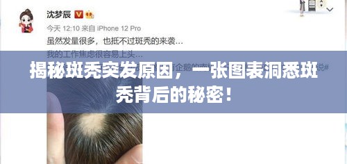 揭秘斑秃突发原因，一张图表洞悉斑秃背后的秘密！