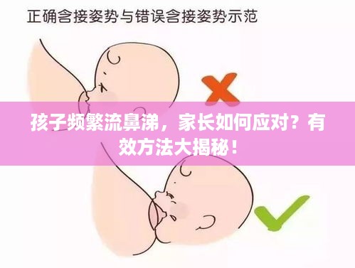 孩子频繁流鼻涕，家长如何应对？有效方法大揭秘！