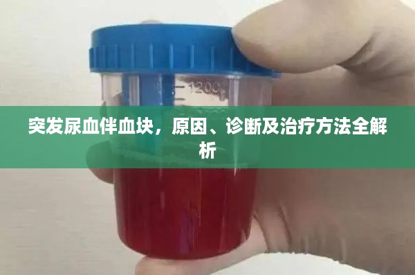 突发尿血伴血块，原因、诊断及治疗方法全解析