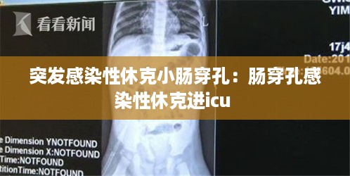 瑞雪纷飞 第2页