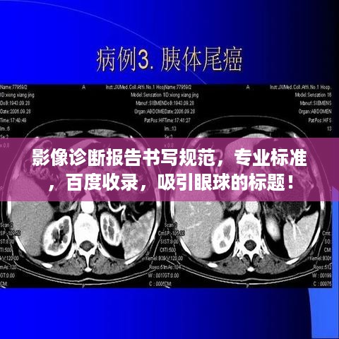影像诊断报告书写规范，专业标准，百度收录，吸引眼球的标题！