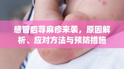感冒后荨麻疹来袭，原因解析、应对方法与预防措施