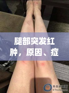 腿部突发红肿，原因、症状与应对之策探讨