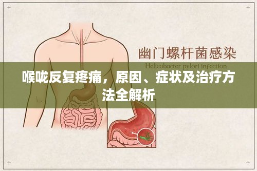 喉咙反复疼痛，原因、症状及治疗方法全解析