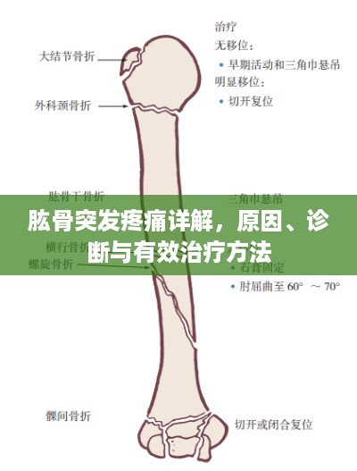肱骨突发疼痛详解，原因、诊断与有效治疗方法