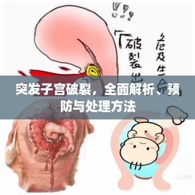 突发子宫破裂，全面解析、预防与处理方法