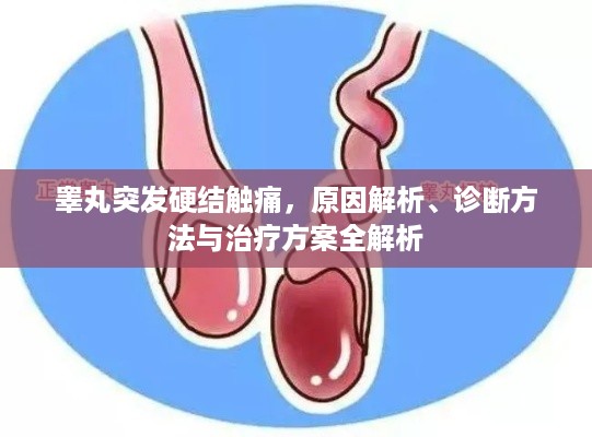 睾丸突发硬结触痛，原因解析、诊断方法与治疗方案全解析