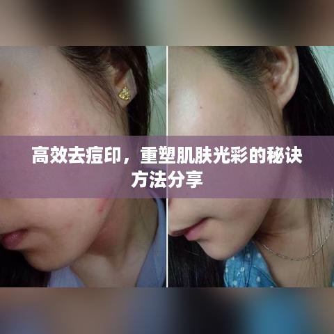 高效去痘印，重塑肌肤光彩的秘诀方法分享