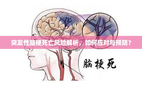 突发性脑梗死亡风险解析，如何应对与预防？