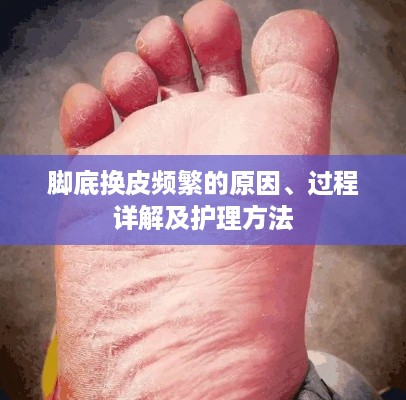 脚底换皮频繁的原因、过程详解及护理方法