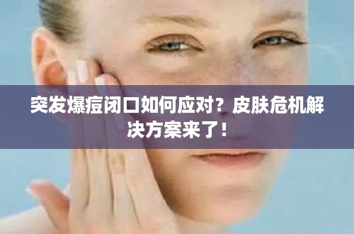 突发爆痘闭口如何应对？皮肤危机解决方案来了！